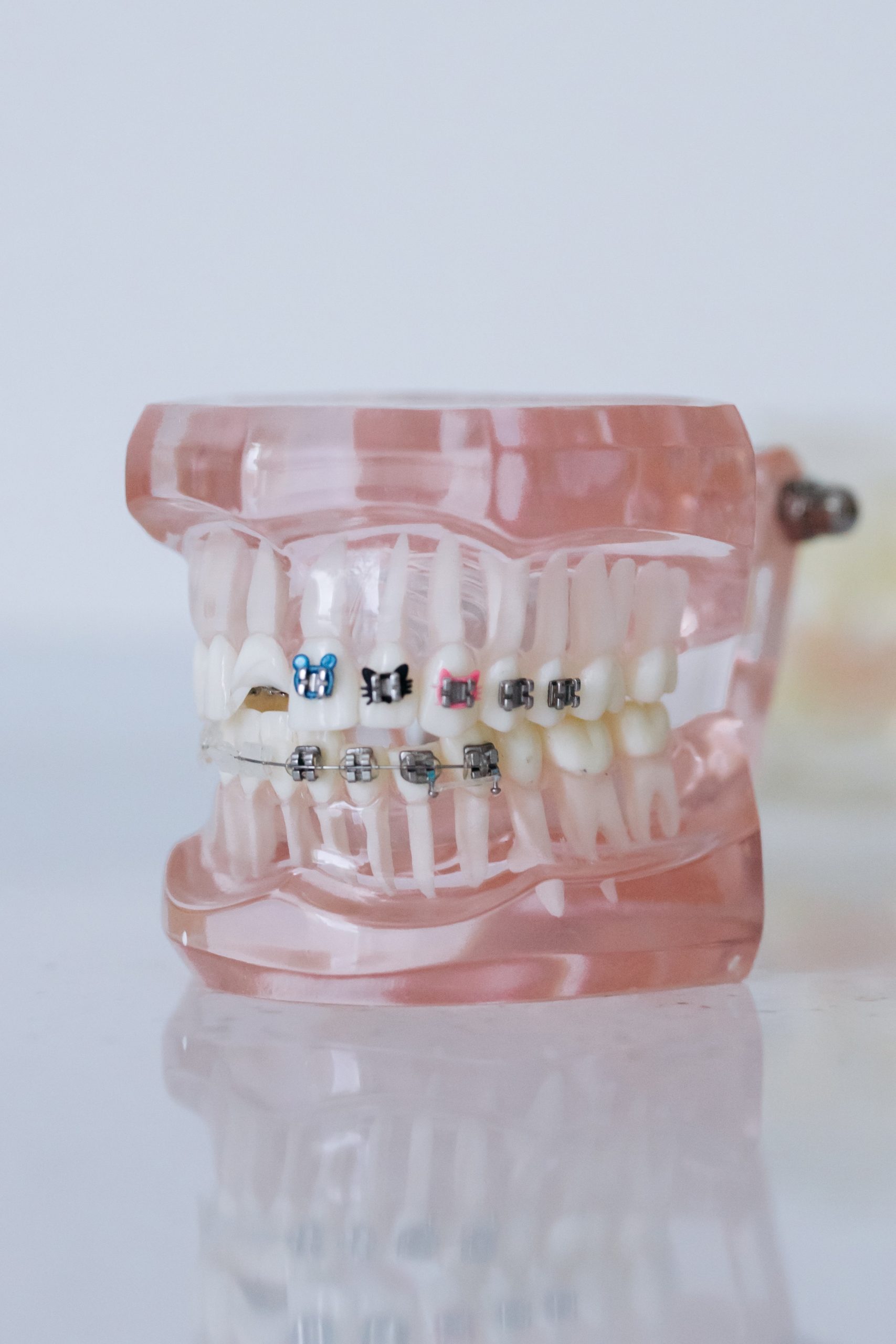 requiring age for orthodontic treatment