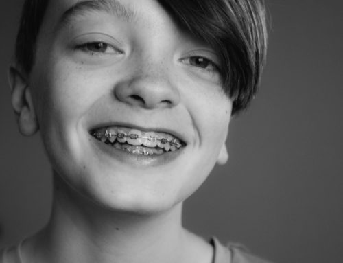 Reasons to Make Braces Part of Your New Year’s Resolutions