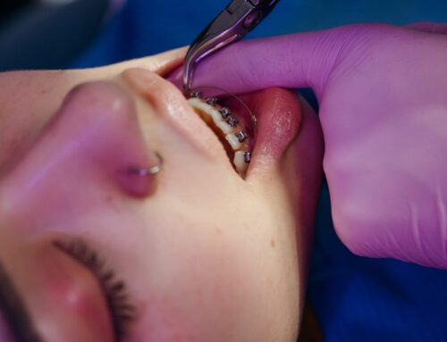 Orthodontic Emergencies: What to Do When Something Goes Wrong