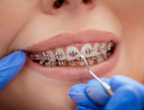 Common Orthodontic Issues and How They Are Treated
