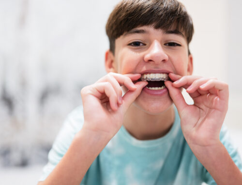 The Science Behind Orthodontic Tooth Movement