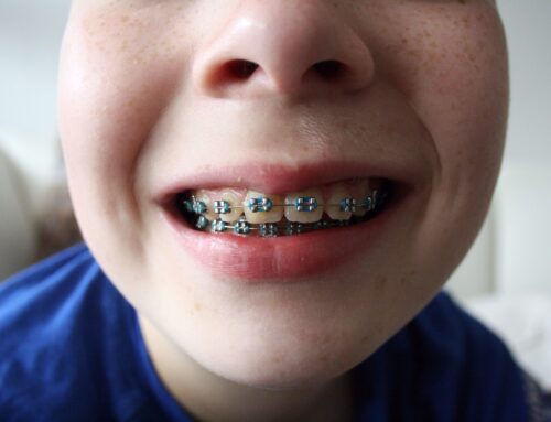 Benefits of Early Orthodontic Intervention for Children