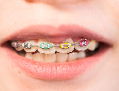 Orthodontic Care for Patients with Special Needs
